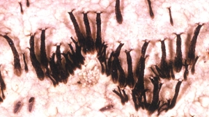 simulium blackfly larvae