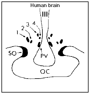 INAH nuclei in human hypothalamus